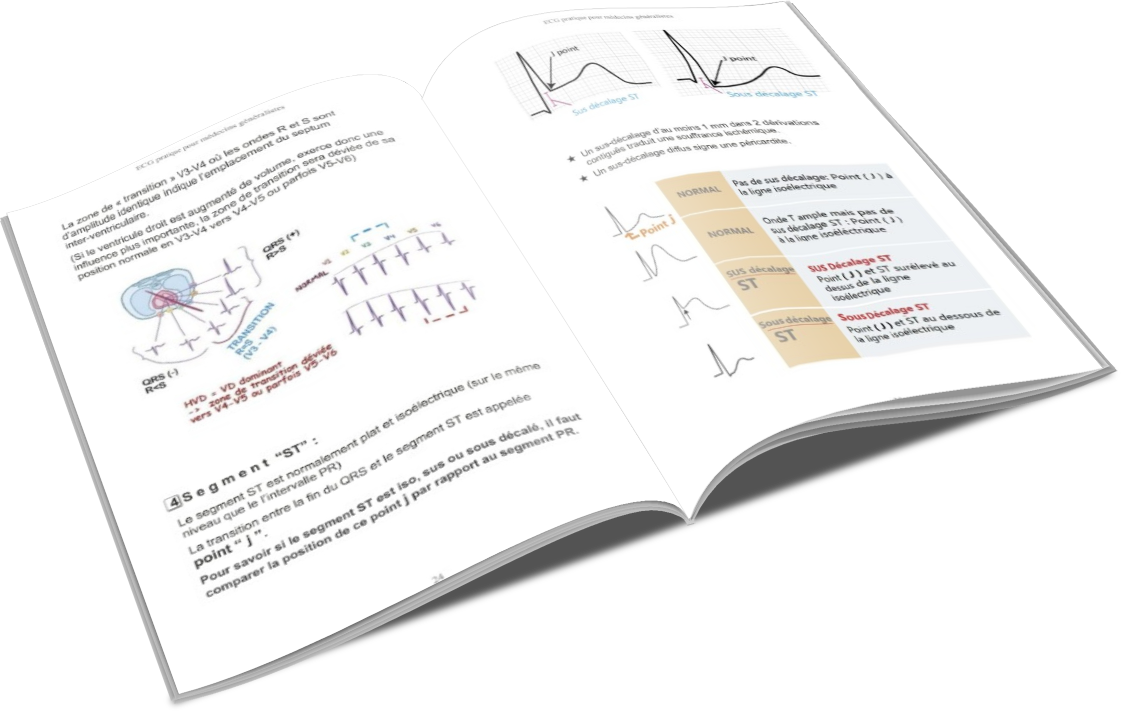 Livre ECG pratique