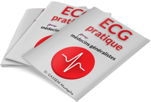 ECG
