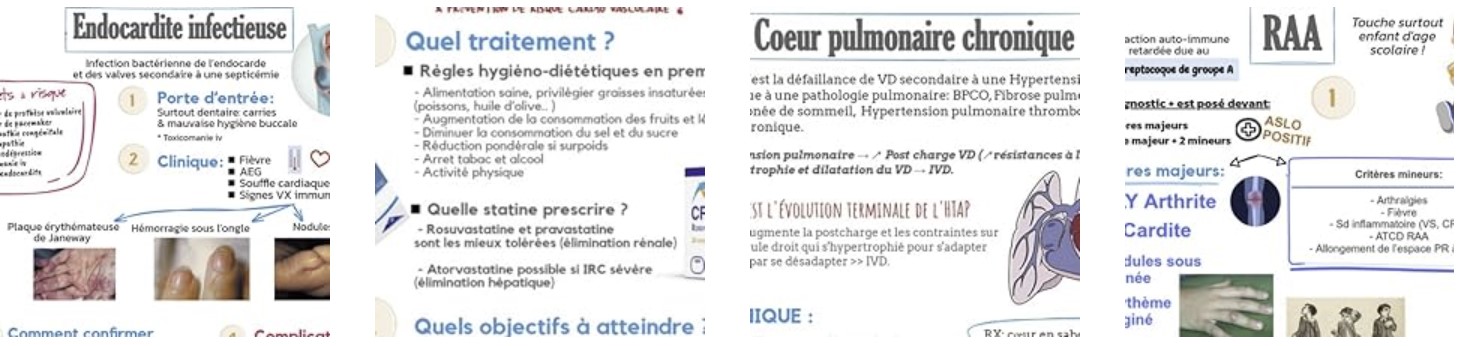 Résumés Cardiologie