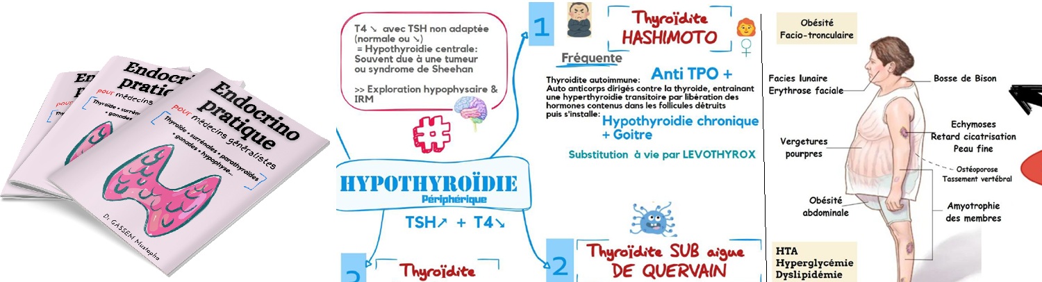 Fiches résumés — Endocrinologie pratique