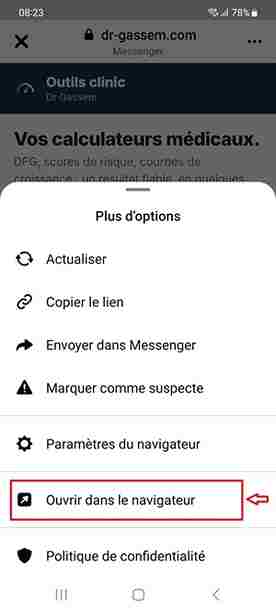 Ouvrir dans le navigateur