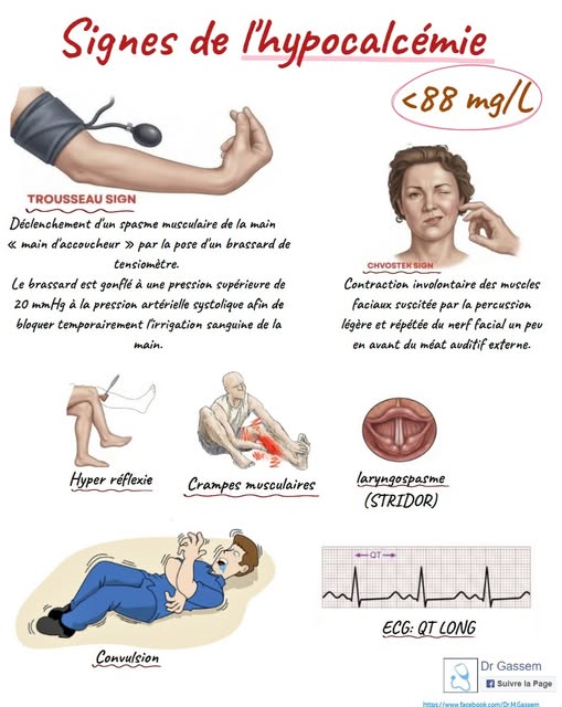 Hypocalcémie